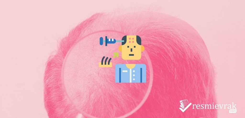 Saç Mezoterapisi Fiyatları