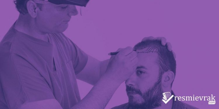 Saç Mezoterapisi Fiyatları